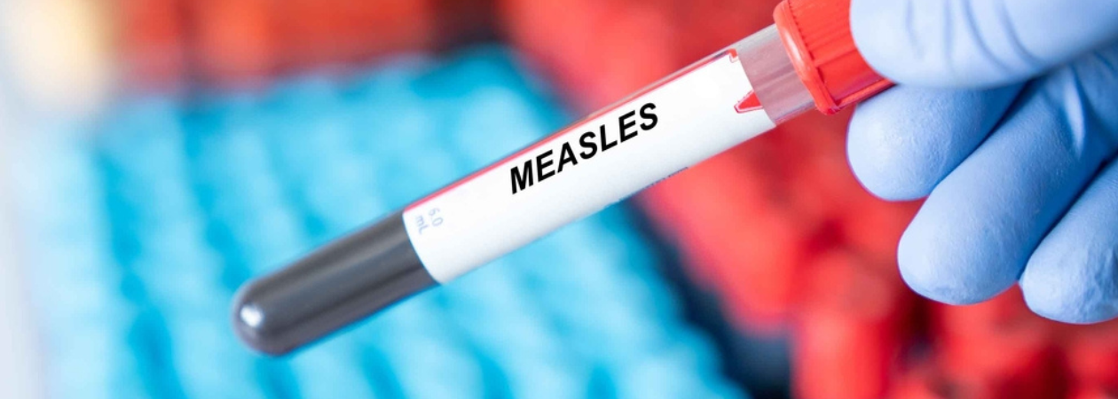 Children at risk as measles cases rise